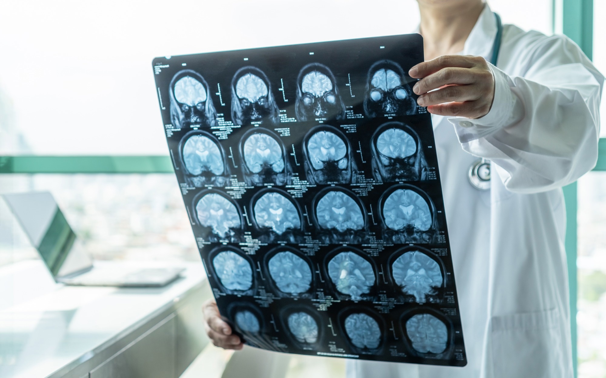 Study: clinical biomarker-based biological aging and future risk of neurological disease in the UK Biobank.  Image Credit: Chinnapong/Shutterstock.com