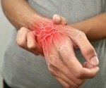 Study links lower testosterone levels with increased arthritis risk