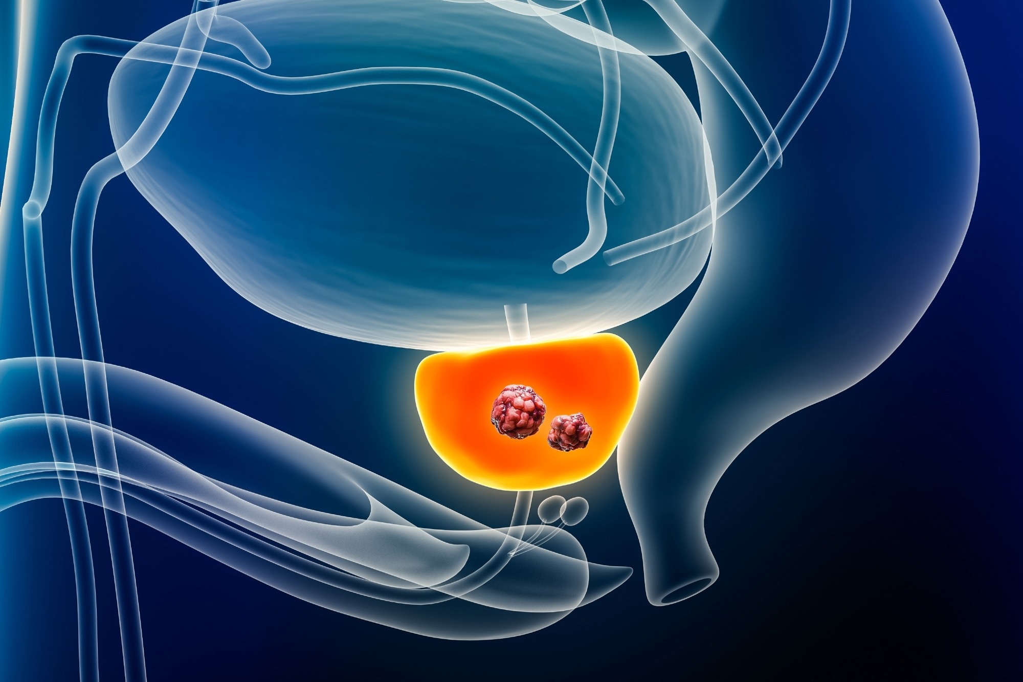 Lettre : Caractérisation du risque de cancer de la prostate grâce à la découverte, à l'échelle du génome, de 187 nouvelles variantes de risque ayant de multiples ascendances.  Crédit photo : MattL_Images / Shutterstock