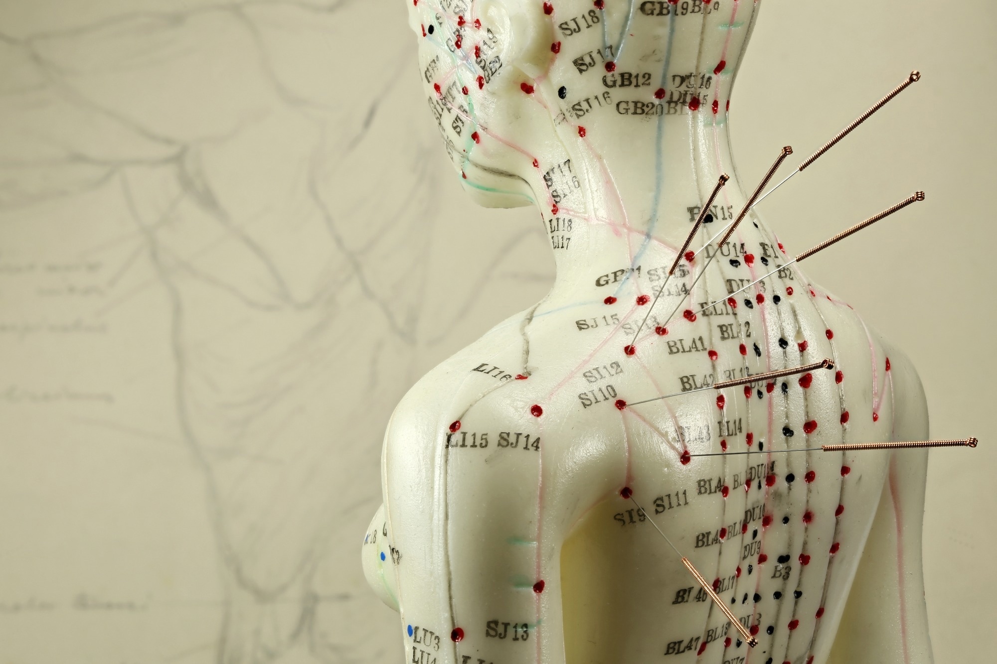 Study: Acupuncture vs Massage for Pain in Patients Living With Advanced Cancer. Image Credit: Bjoern Wylezich / Shutterstock