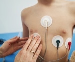 Lasting heart concerns in kids post-MIS-C: Study urges ongoing cardiac checks