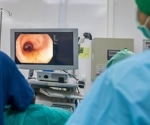 AI transforms colonoscopy: Boosting detection rates, slashing miss rates in cancer screening