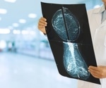 Mammography's effectiveness uncertain in women over 75, study shows