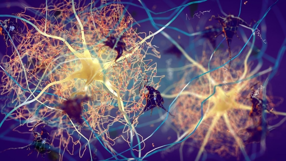 Study: Decoding metabolic signatures in Alzheimer’s disease: a mitochondrial perspective. Image Credit: nobeastsofierce/Shutterstock.com