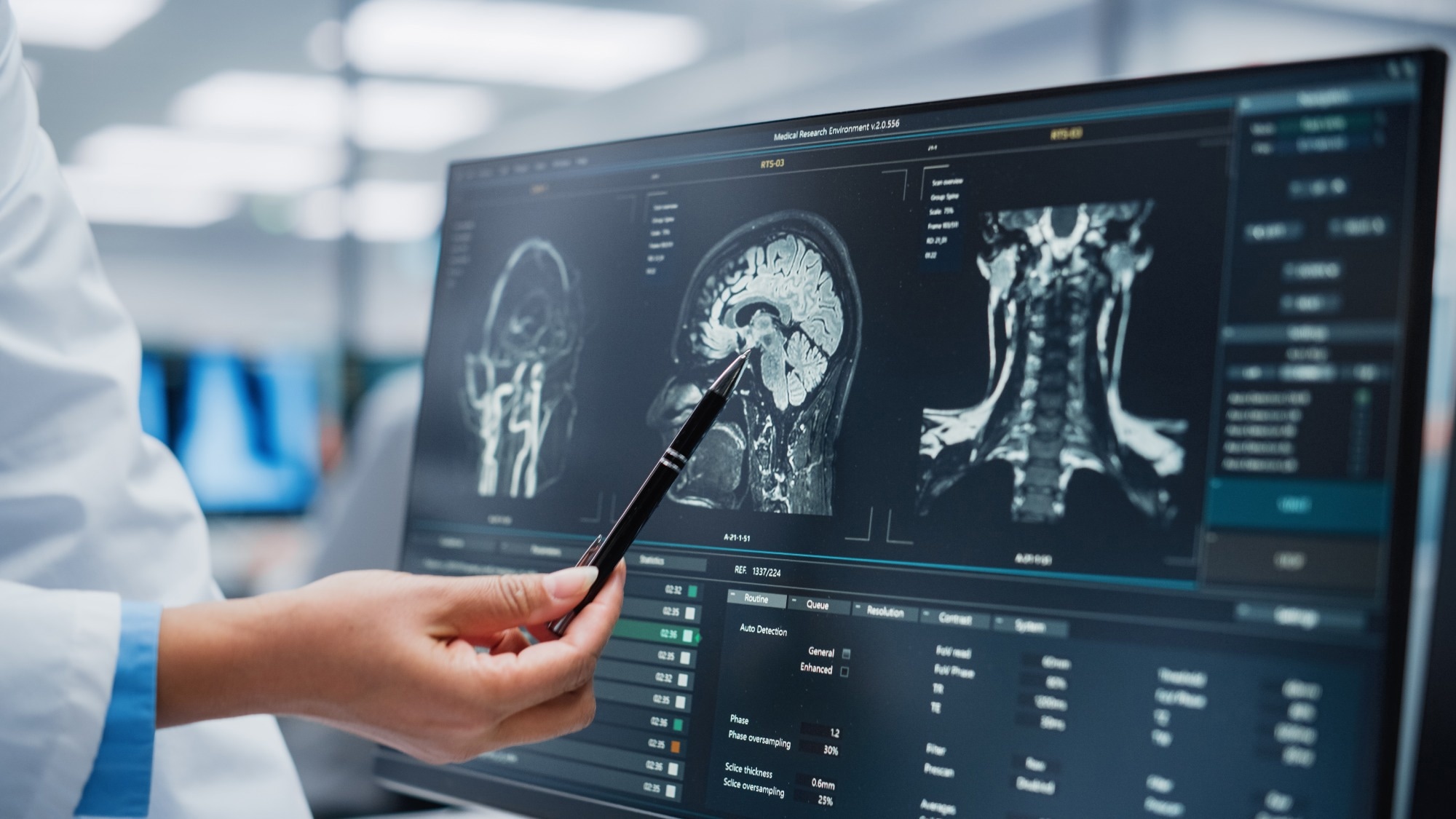 Study: Improving portable low-field MRI image quality through image-to-image translation using paired low- and high-field images. Image Credit: Gorodenkoff/Shutterstock.com