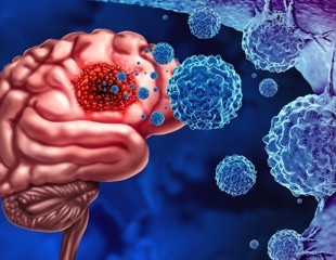 The association between viral infections and glioma risk