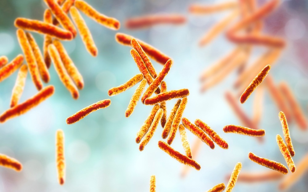 Study: First isolation of Mycobacterium saskatchewanense from medical devices. Image Credit: Kateryna Kon/Shutterstock.com