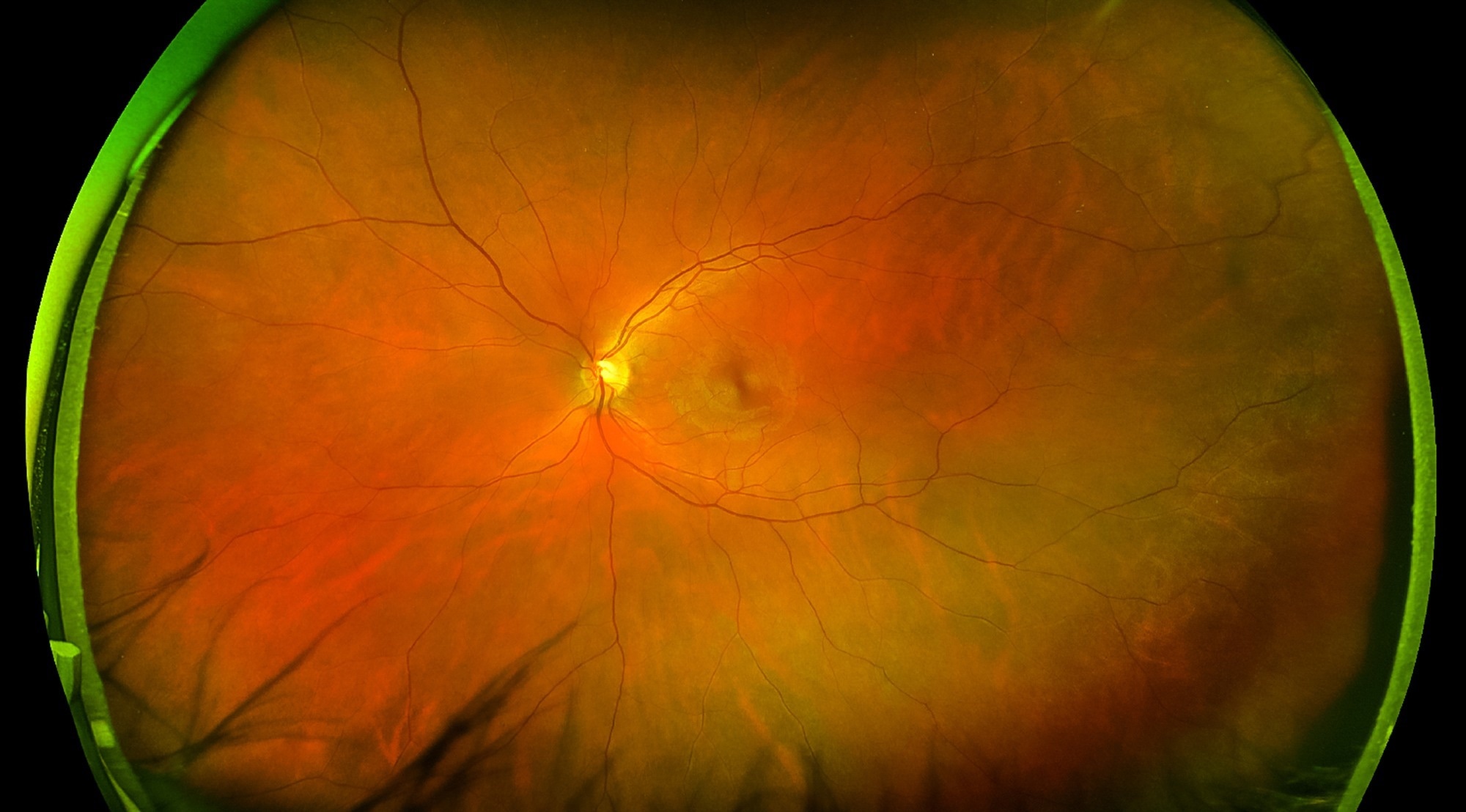 Study: Development of Deep Ensembles to Screen for Autism and Symptom Severity Using Retinal Photographs. Image Credit: yogenystocker / Shutterstock