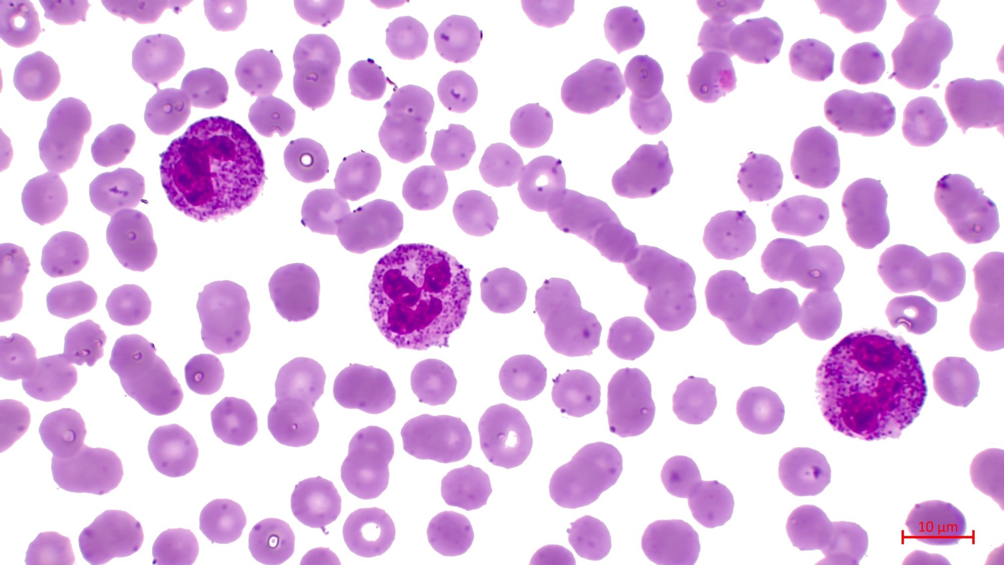 Study: Neutrophils: from IBD to the gut microbiota. Image Credit: BioFoto / Shutterstock.com