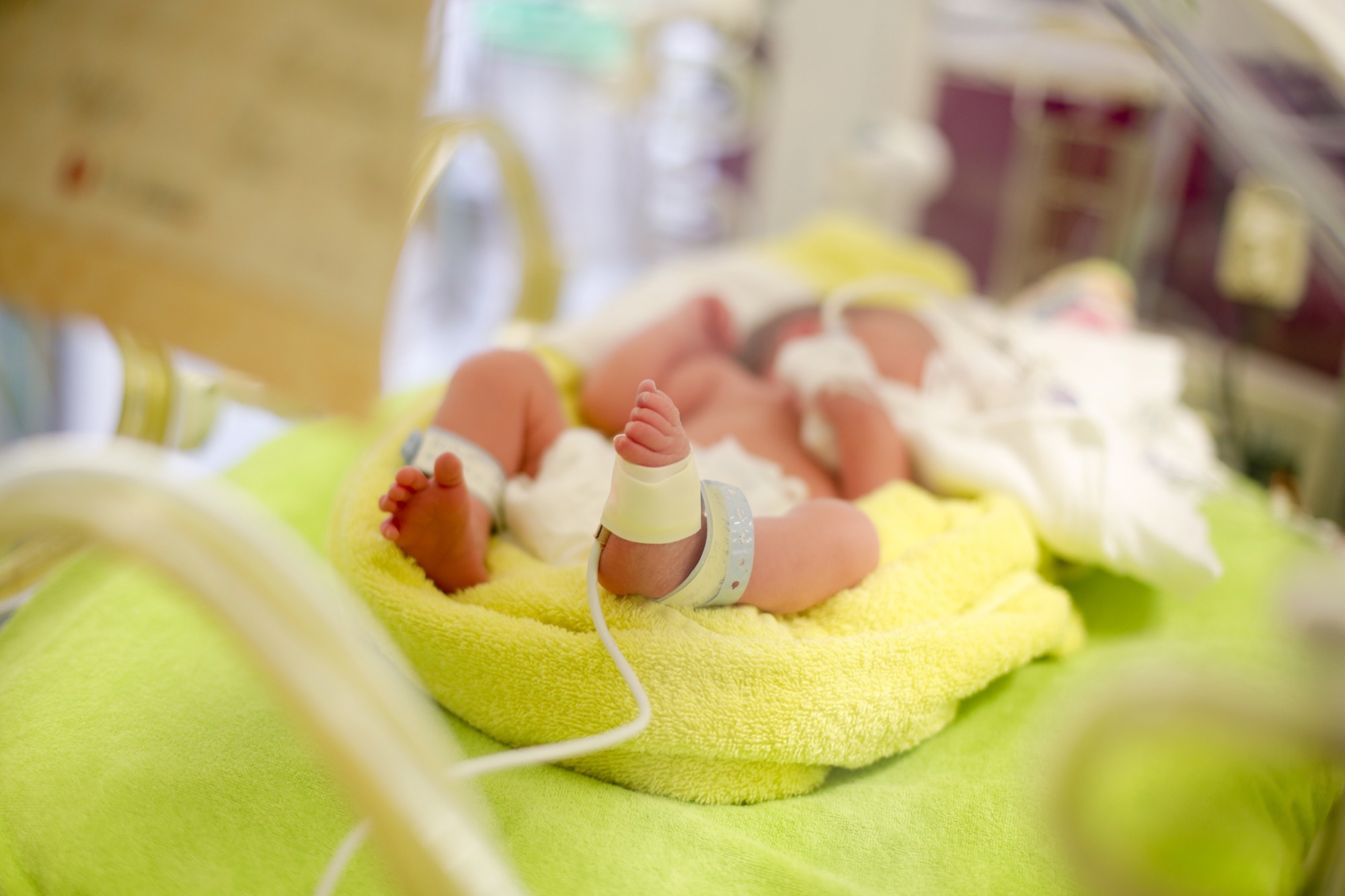 Studie: Wirkung der Anreicherung auf Muttermilchbasis bei extrem Frühgeborenen, die ausschließlich mit Muttermilch ernährt wurden: eine randomisierte kontrollierte Studie.  Bildnachweis: LullaBEE / Shutterstock