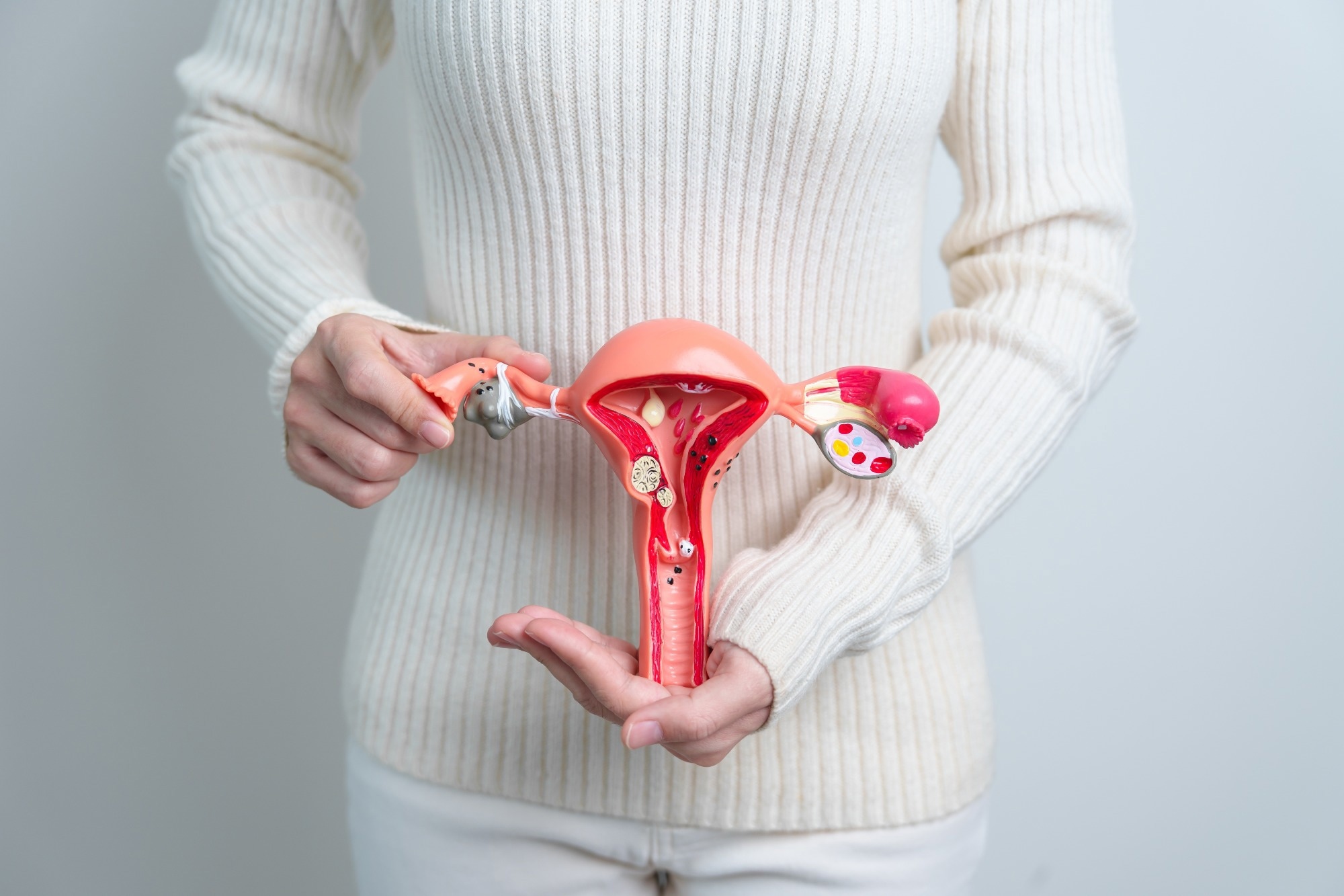 Study: How Can Selected Dietary Ingredients Influence the Development and Progression of Endometriosis? Image Credit: Jo Panuwat D/Shutterstock.com