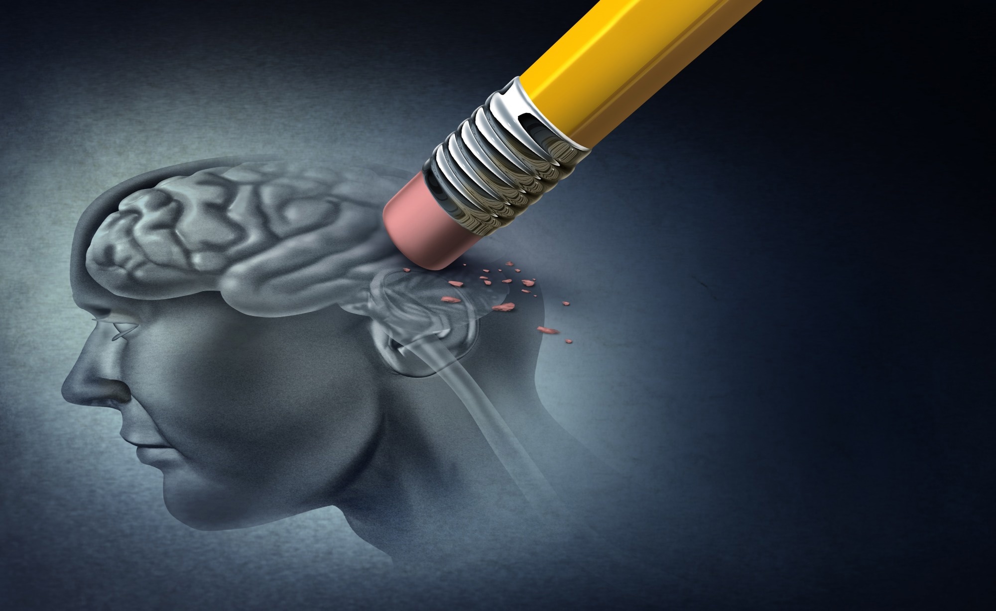 Letter: Cerebrospinal fluid proteomics in patients with Alzheimer’s disease reveals five molecular subtypes with distinct genetic risk profiles. Image Credit: Lightspring / Shutterstock
