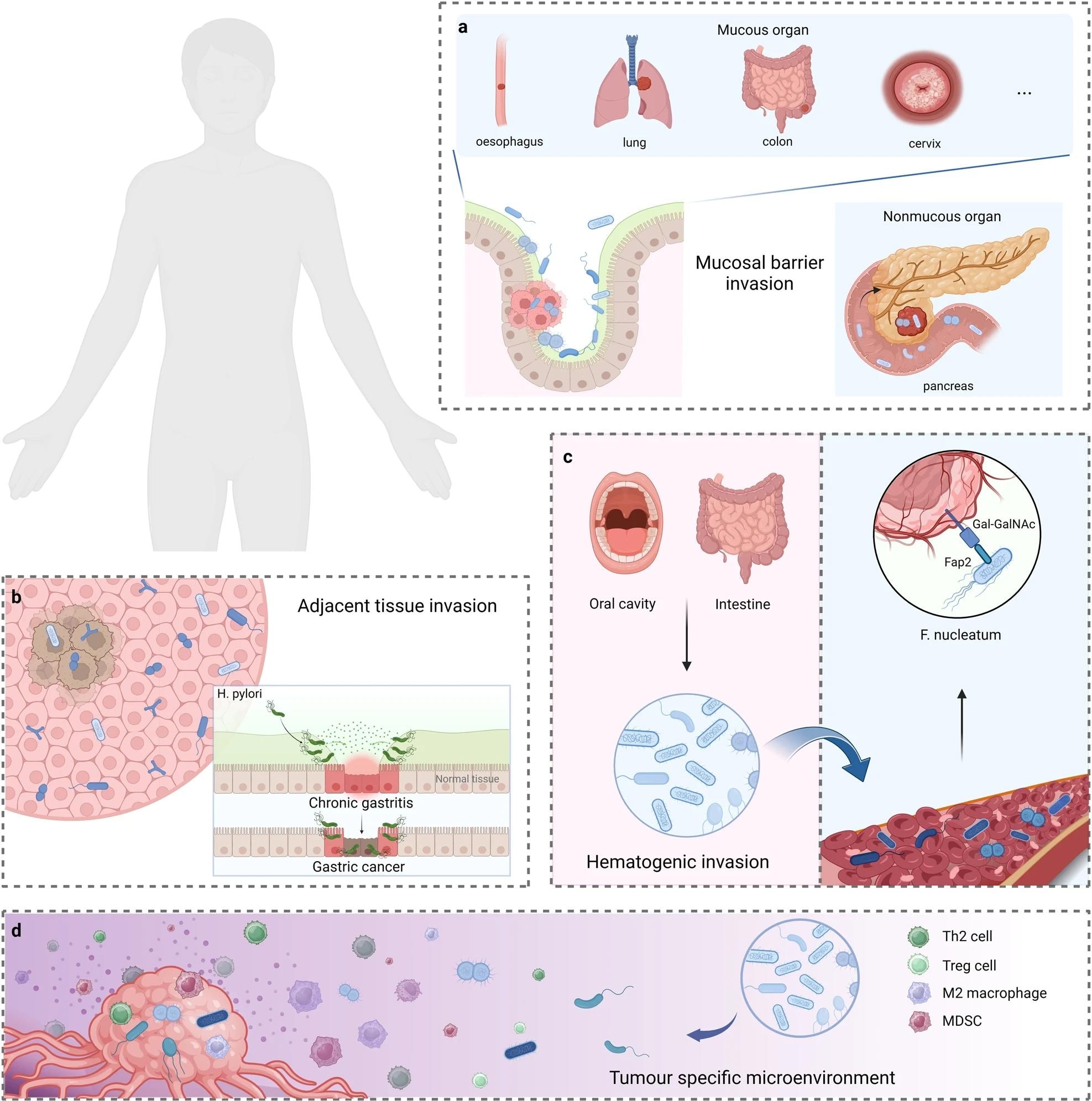 The potential origins of intratumoural microbiota. a Mucosal barrier invasion. Microorganisms may invade the tumor through the damaged mucosa. b Adjacent tissue invasion. the microbiome community between the tumor and adjacent normal tissue shares many similarities. c Hematogenic invasion. microorganisms from the oral cavity, intestine, and other potential locations may be carried to the tumor locations and colonize the tumor through destroyed blood vessels. d Attraction of tumor-specific microenvironment. immunosuppressive, hypoxic, and metabolic nutrient-enriched environments in tumors may enhance microbial colonization. Created with BioRender.com
