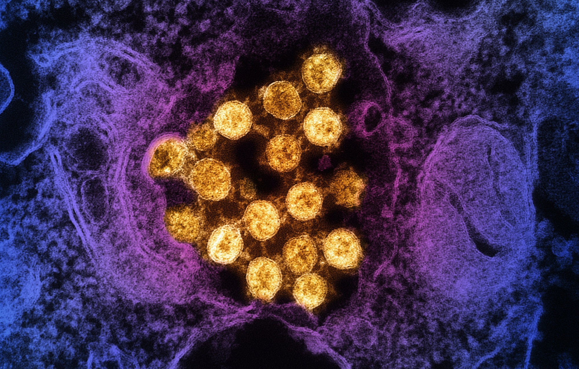 Study: Public Health Impact of Paxlovid as Treatment for COVID-19, United States. Transmission electron micrograph of SARS-CoV-2 virus particles (colorized gold), isolated from a patient sample. Image captured at the NIAID Integrated Research Facility (IRF) in Fort Detrick, Maryland. Image Credit: NIAID