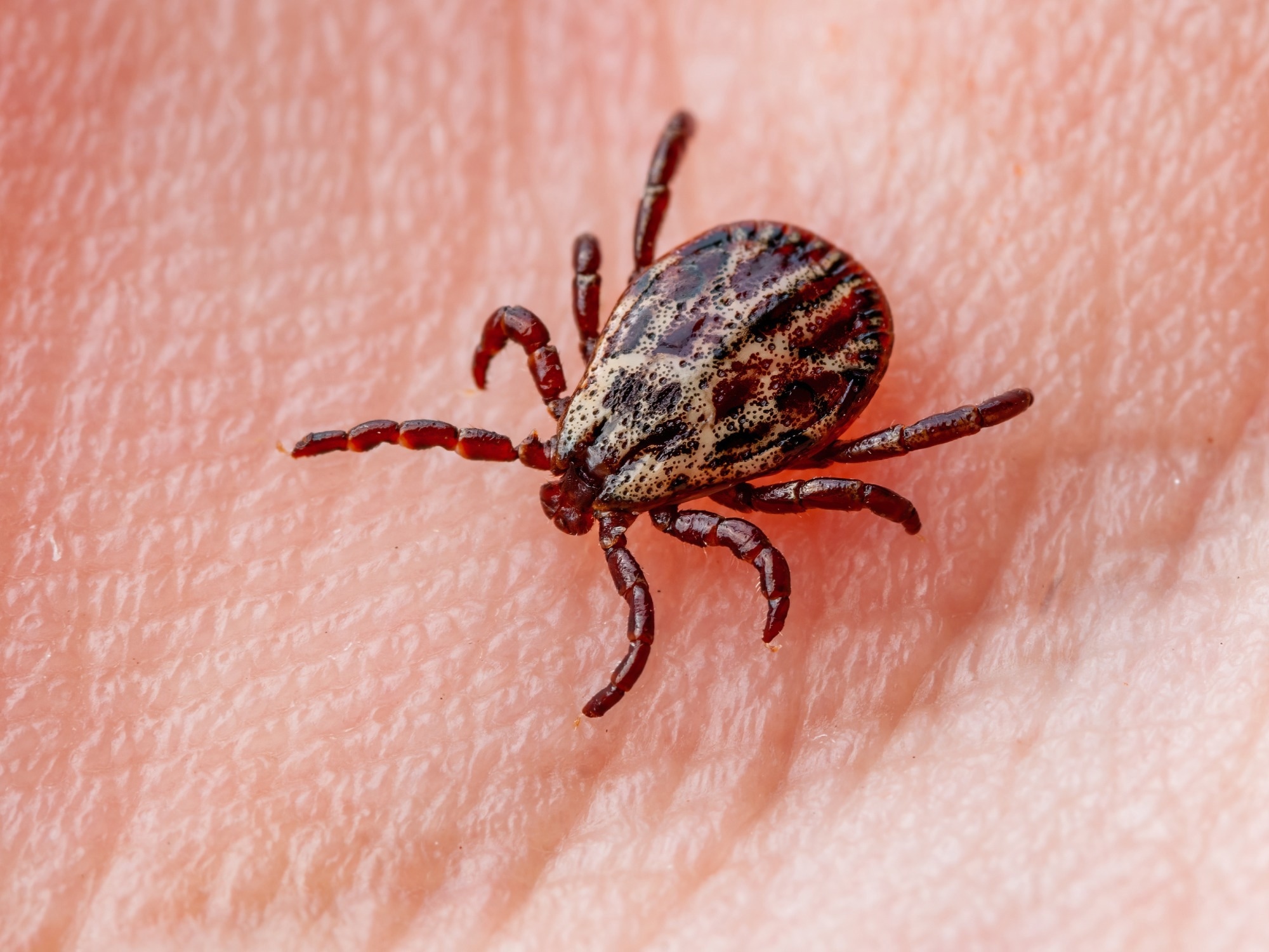 Study: Tick-Borne Disease Infections and Chronic Musculoskeletal Pain. Image Credit: nechaevkon/Shutterstock.com
