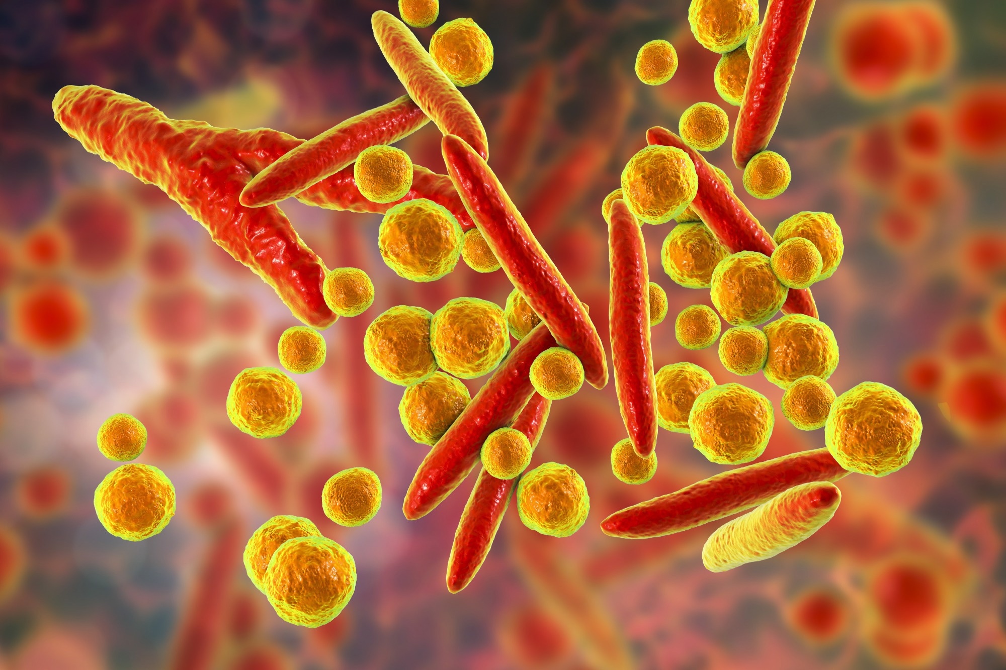 Study: Increased incidence of Mycoplasma pneumoniae infections and hospitalizations in the Netherlands, November to December 2023.  Image credit: Katerina Kahn/Shutterstock