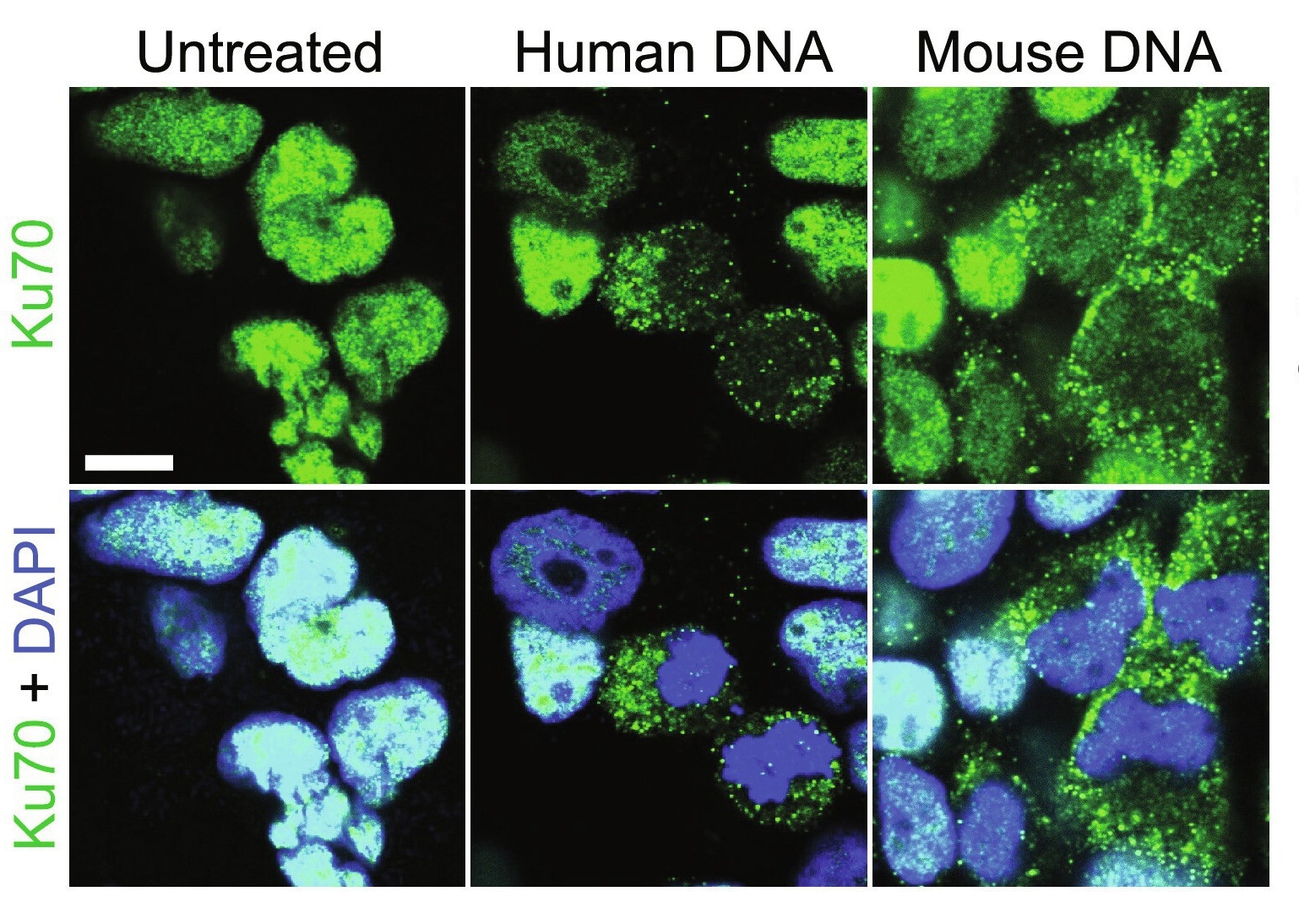 Study: Ku70 senses cytosolic DNA and assembles a tumor-suppressive signalosome