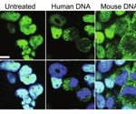 Immune protein Ku70 key in fighting bowel cancer