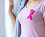 Are younger women experiencing a higher incidence of breast cancer?