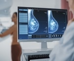 Do deep learning tools outperform humans in diagnosing breast cancer via ultrasound imaging?