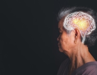 Shared molecular pathways found in Alzheimer's and epilepsy