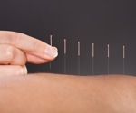Acupuncture is beneficial in reducing the incidence of ischaemic stroke