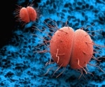Hormonal steroids found to boost drug resistance in gonorrhea bacteria