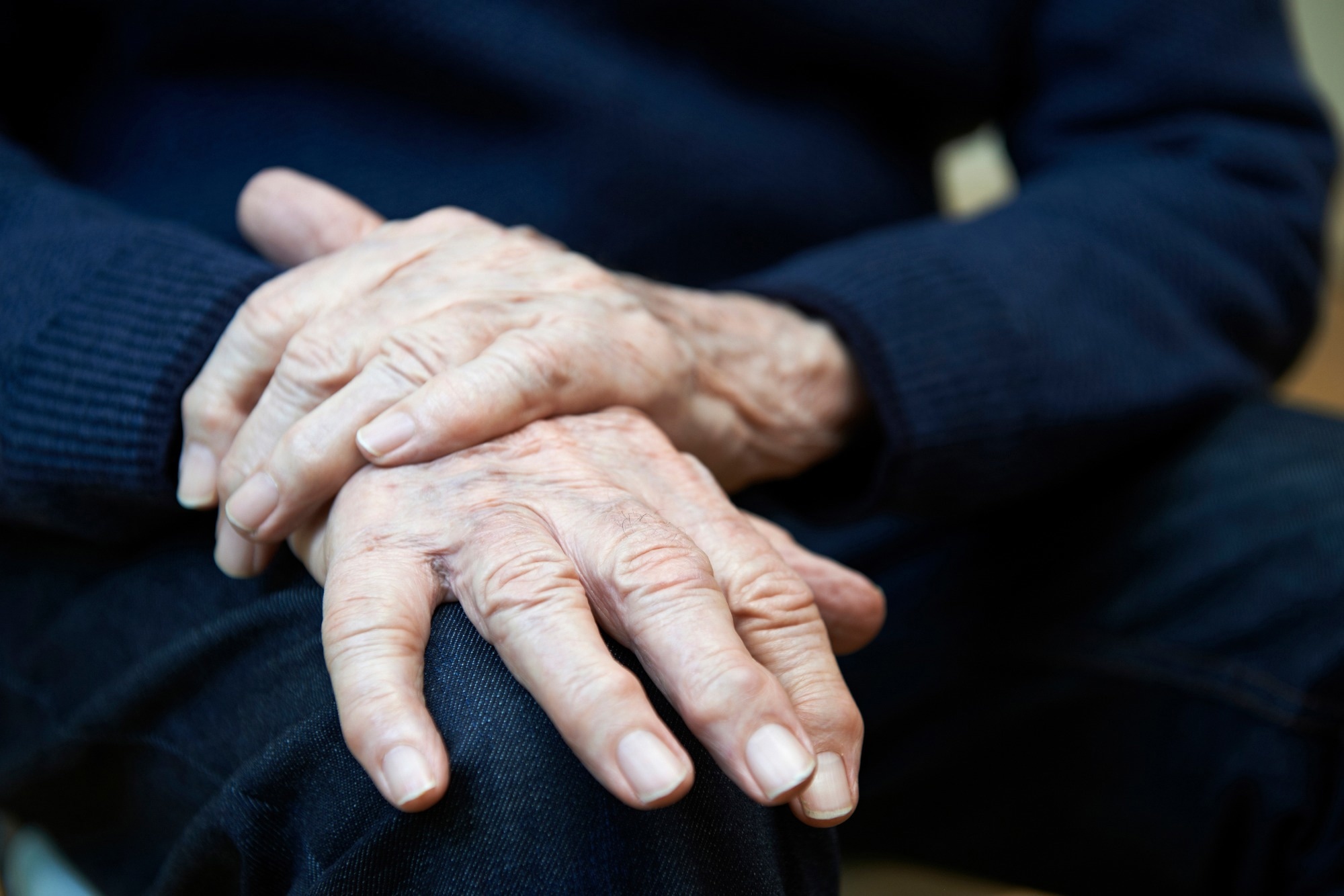 Study: Differences in brain aging between sexes in Parkinson’s disease. Image Credit: SpeedKingz/Shutterstock.com