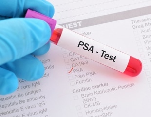 What factors are associated with recent prostate-specific antigen screening in transgender women?