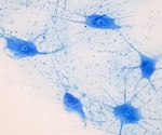 COVID-19's neurological effects linked to immune response, not direct viral attack