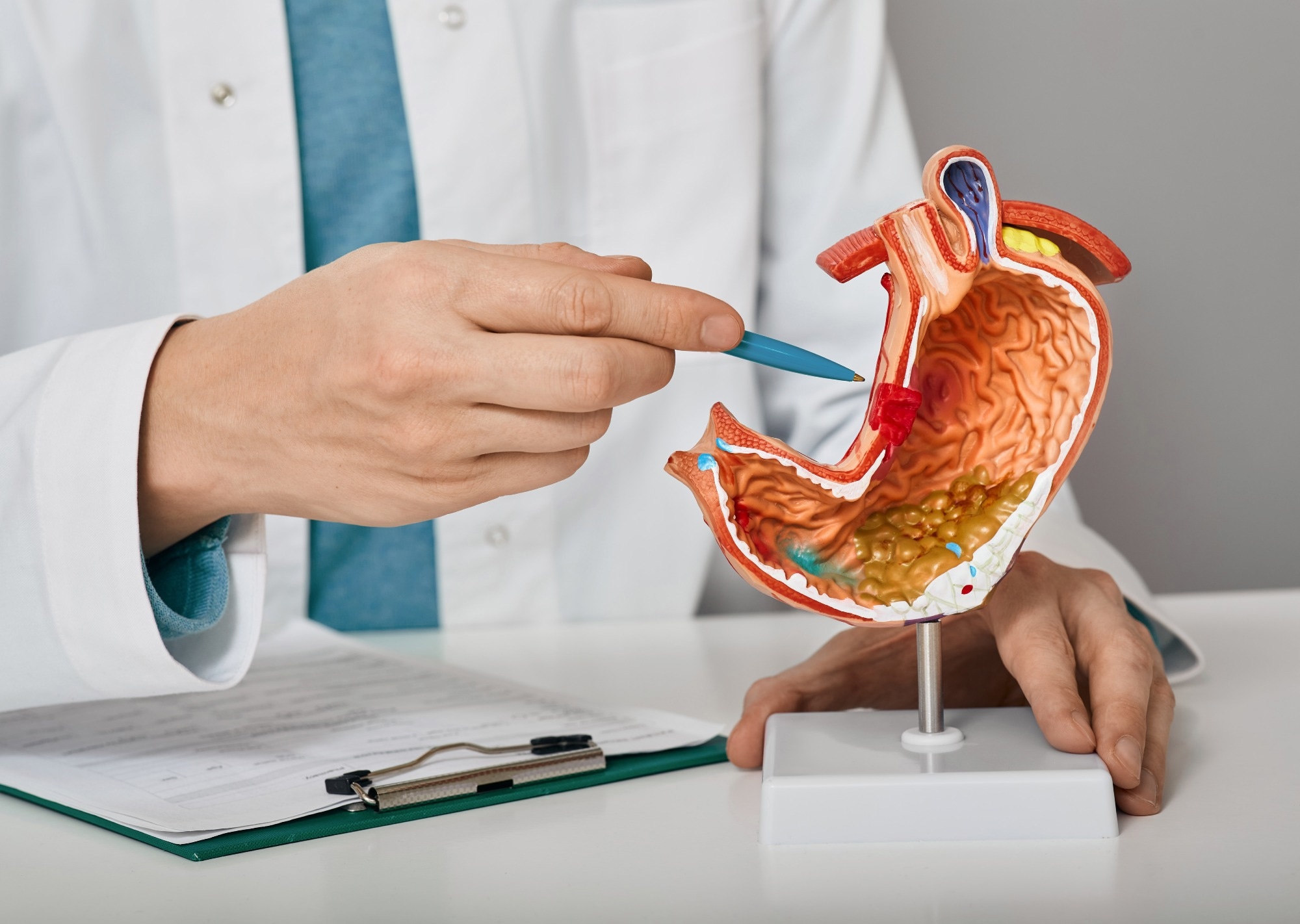 Study: Review of dietary patterns and gastric cancer risk: epidemiology and biological evidence. Image Credit: Peakstock/Shutterstock.com
