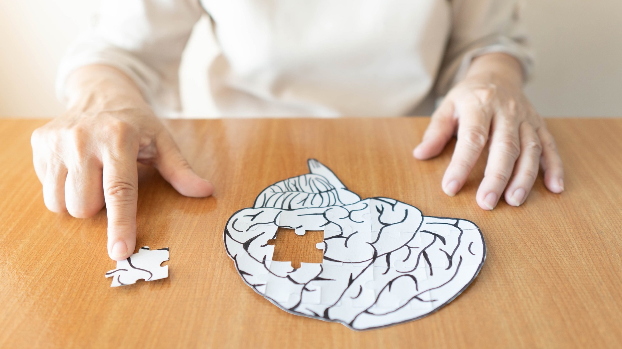 Study: Posttraumatic Epilepsy and Dementia Risk. Image Credit: Orawan Pattarawimonchai/Shutterstock.com