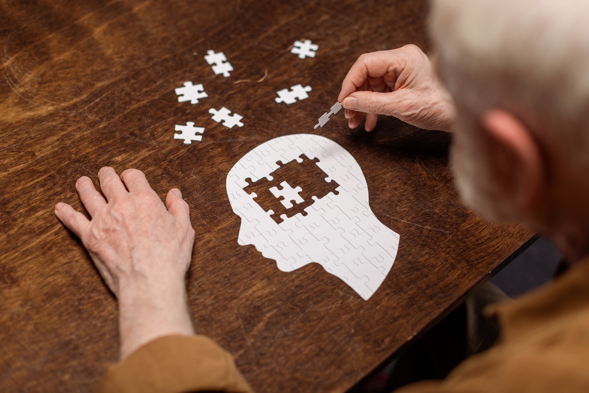 Study: Posttraumatic Epilepsy and Dementia Risk. Image Credit: LightField Studios/Shutterstock.com