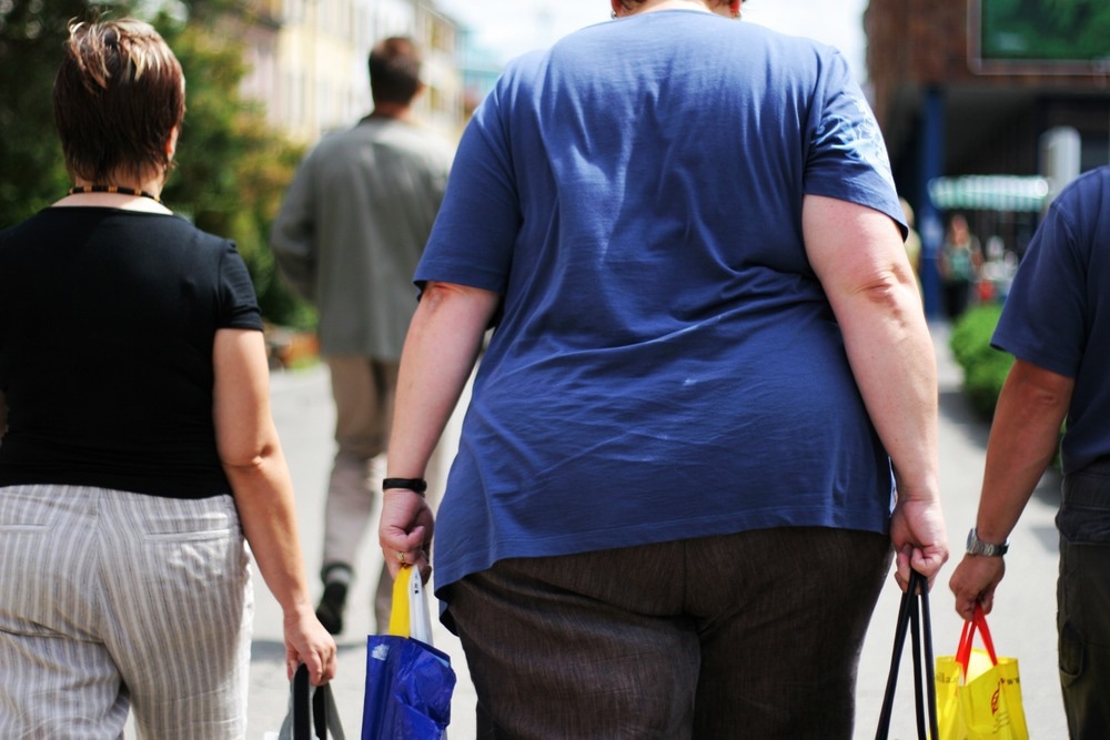 Study: Worldwide trends in underweight and obesity from 1990 to 2022: a pooled analysis of 3663 population-representative studies with 222 million children, adolescents, and adults. Image Credit: Jakub Cejpek/Shutterstock.com