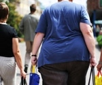 Combined prevalence of underweight and obesity has increased in most countries since 1990, study reports