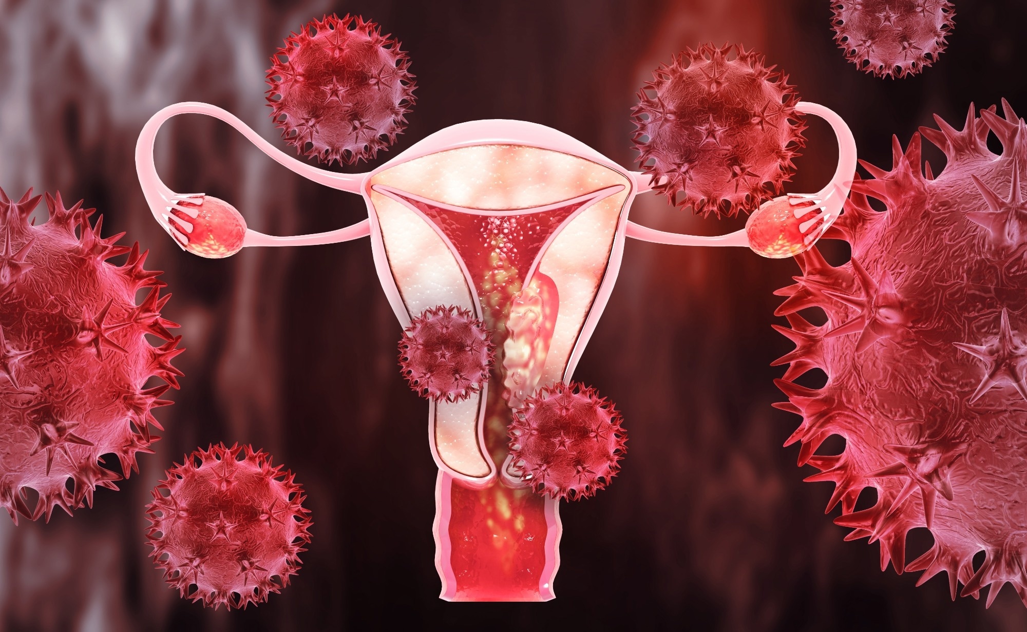 Study: Detection of endometrial cancer in cervicovaginal fluid and blood plasma: leveraging proteomics and machine learning for biomarker discovery. Image Credit: crystal light / Shutterstock.com