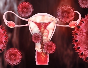 Study reveals breakthrough in non-invasive detection of endometrial cancer