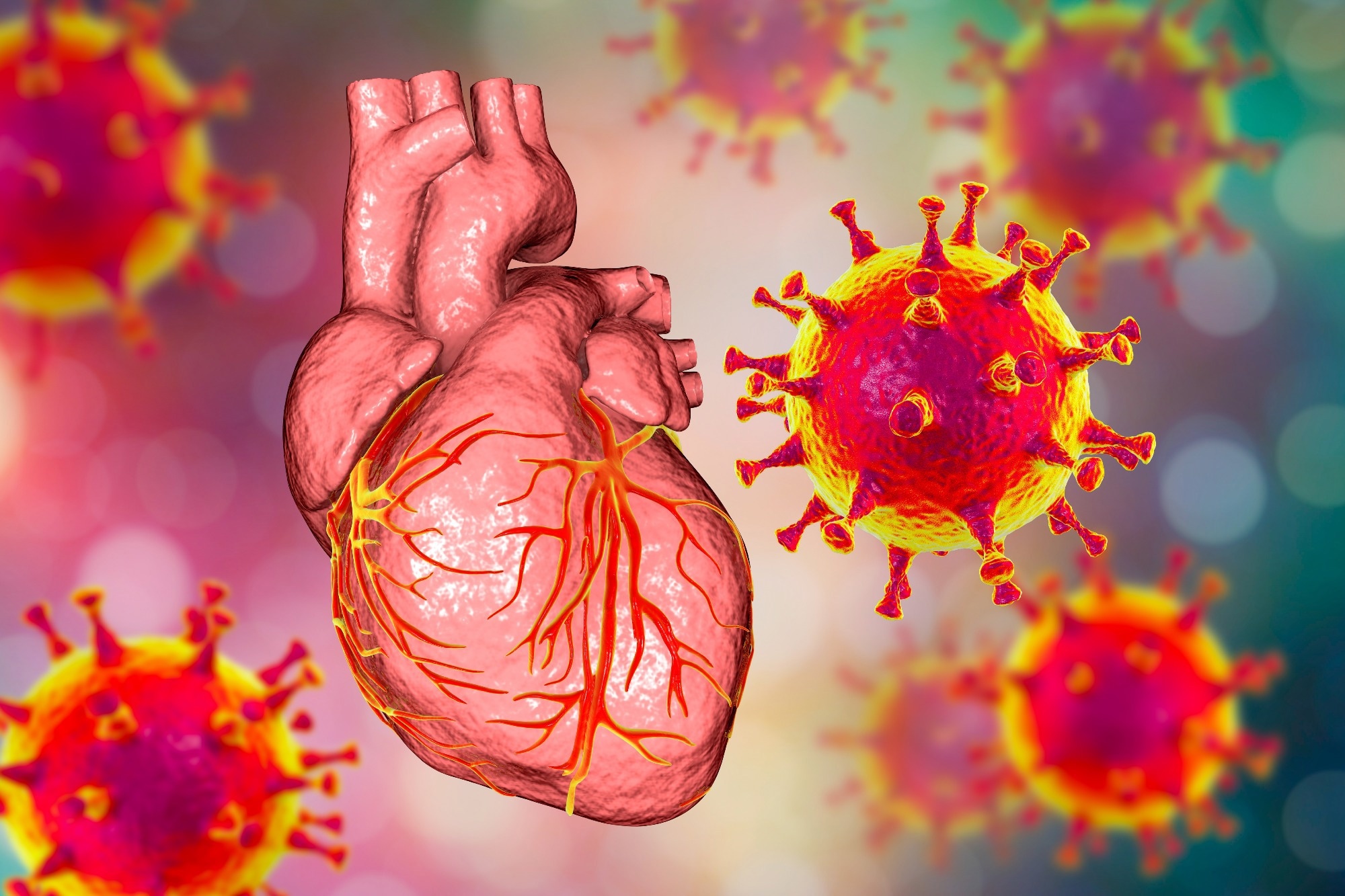Study: Virus-Induced Acute Respiratory Distress Syndrome Causes Cardiomyopathy Through Eliciting Inflammatory Responses in the Heart. Image Credit: Kateryna Kon / Shutterstock