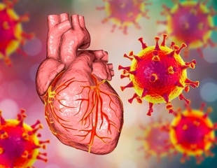 Heart at risk from ARDS: Inflammatory responses fuel cardiovascular complications