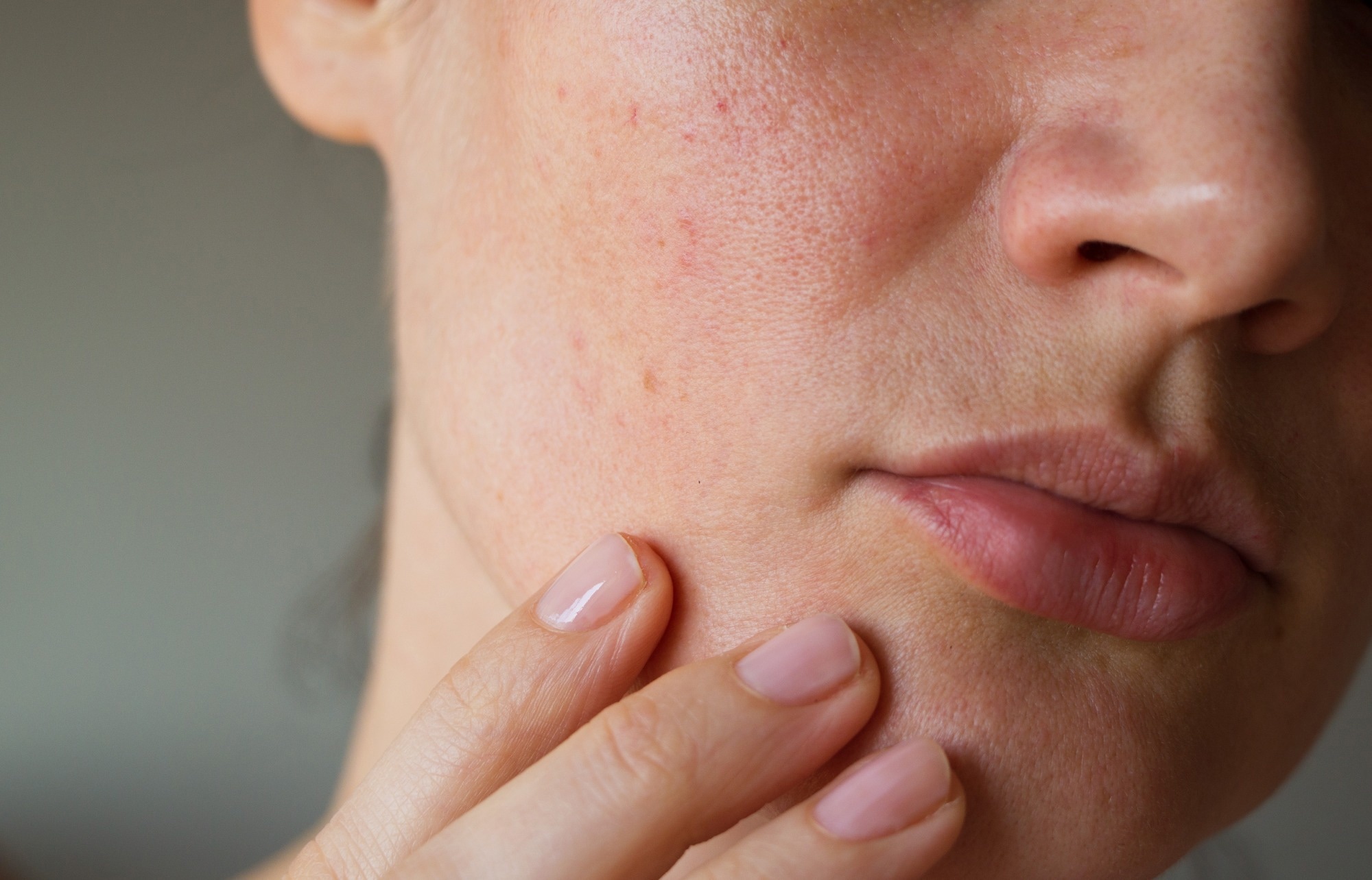 Study: Effects of psychological stress on the emission of volatile organic compounds from the skin. Image Credit: Geinz Angelina/Shutterstock.com