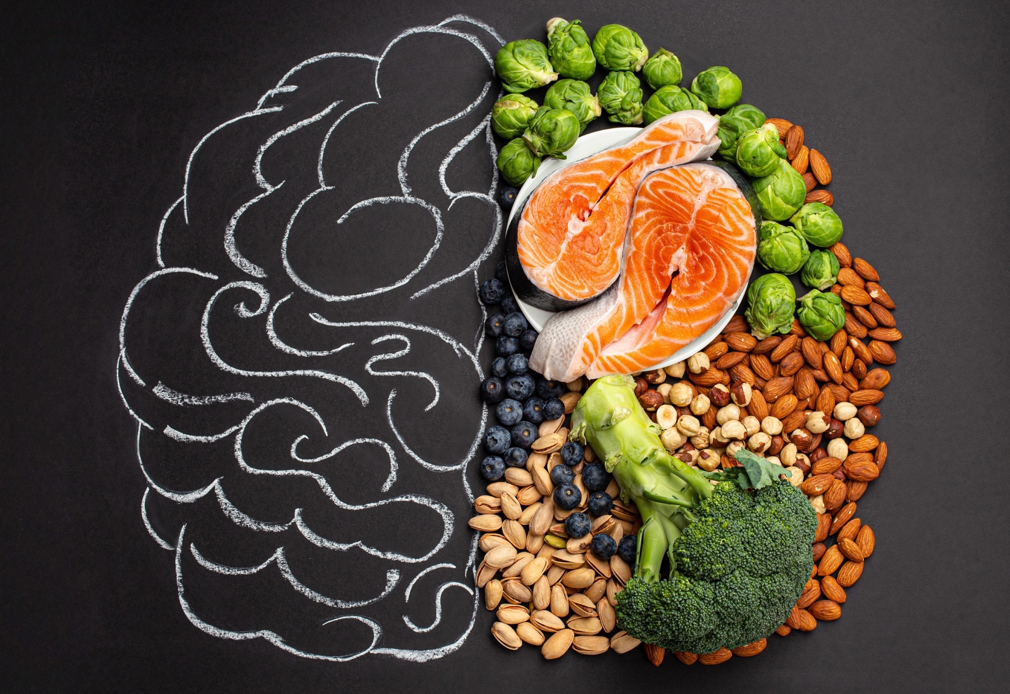 Study: Associations of dietary patterns with brain health from behavioral, neuroimaging, biochemical and genetic analyses. Image Credit: Elena Eryomenko / Shutterstock
