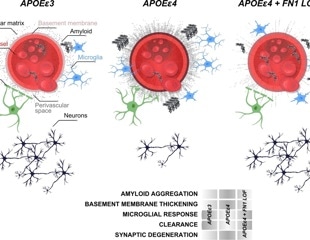 Study unlocks genetic secrets in APOEε4 carriers that could defend against Alzheimer's
