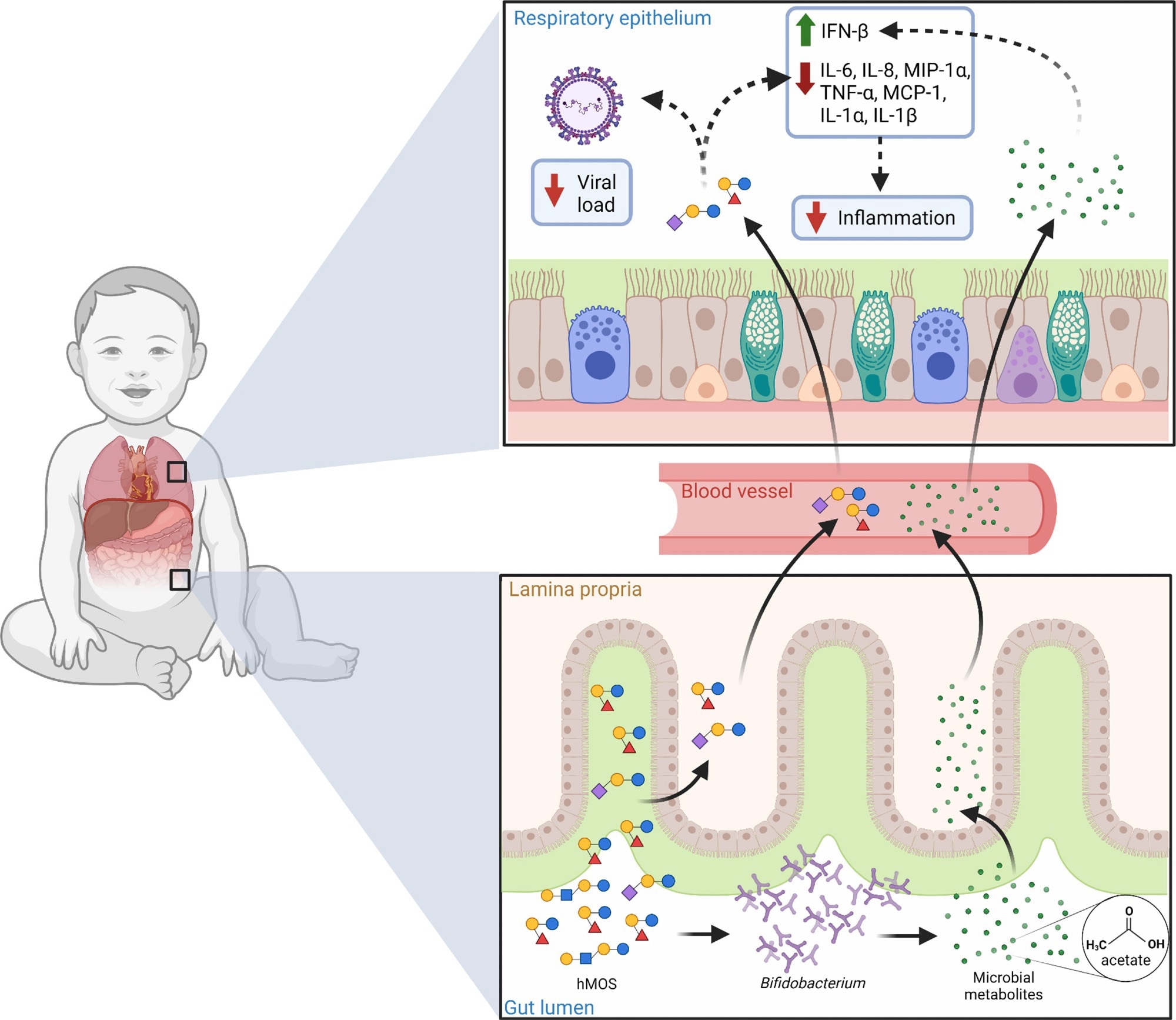 Potential role of hMOS on RSV disease. hMOS such as 2’-FL and LNnT are metabolized by Bifidobacterium in the infant’s gut into short-chain fatty acids, like acetate. Small quantities of hMOS and acetate are absorbed and can reach the lungs through the circulation, where they could act as antivirals and modulate inflammation. Small quantities of hMOS and short-chain fatty acids could also coat the upper respiratory mucosa in the form of regurgitated milk as seen in the nose of breast-fed infants. Review:  Human milk oligosaccharides and respiratory syncytial virus infection in infants