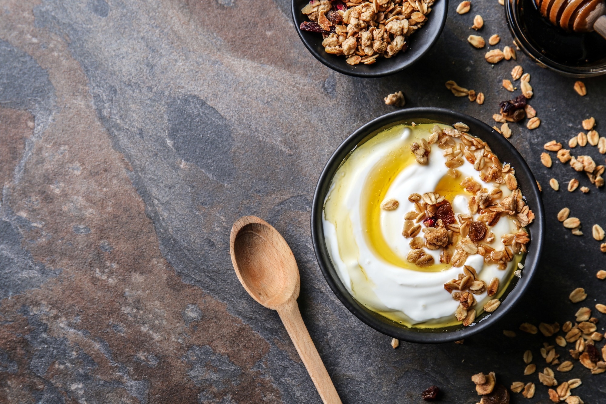 The role of yogurt in diabetes and obesity prevention