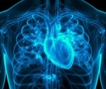 Rising trend in atrial fibrillation risk over 20 years heightens concern for related heart and stroke complications