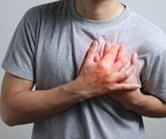 Younger adults with atrial fibrillation face higher rates of heart failure and stroke