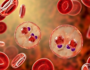 New monoclonal antibody vaccine slashes malaria risk in children