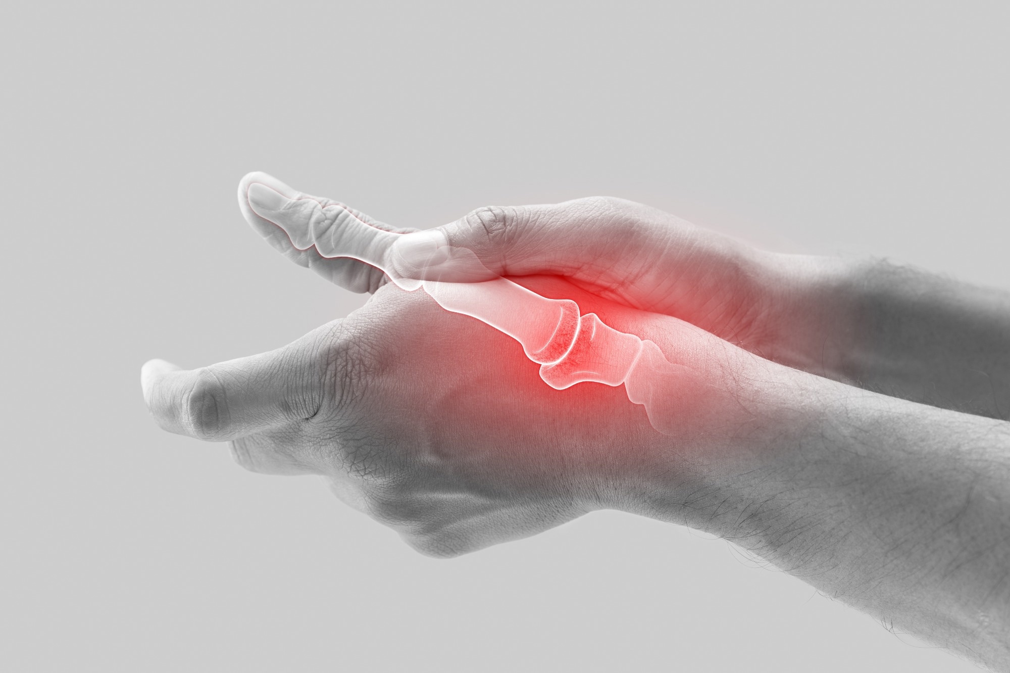Study: No genetic causal association between circulating alpha-tocopherol levels and osteoarthritis, a two-sample Mendelian randomization analysis. Image Credit: Emily frost / Shutterstock.com