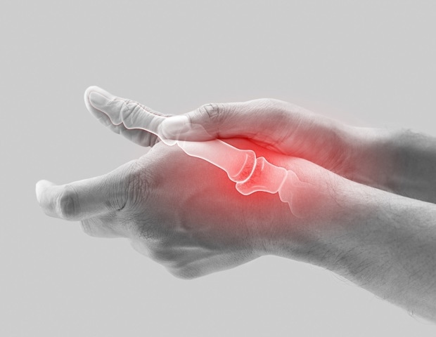 New research finds no causal link between vitamin E levels and osteoarthritis
