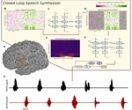 Brain-computer interface translates ALS patient's brain activity into spoken words